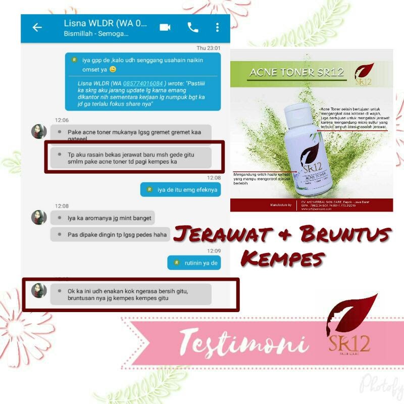 SR12 Acne Toner - Perawatan dan Pembersih Jerawat Untuk Muka Wajah - SR12 Skincare - Skin Care