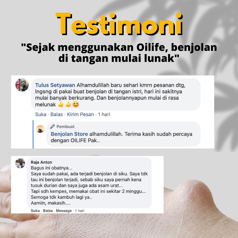 OILIFE Obat Herbal Gangilon / Minyak Oles Untuk Gangilon