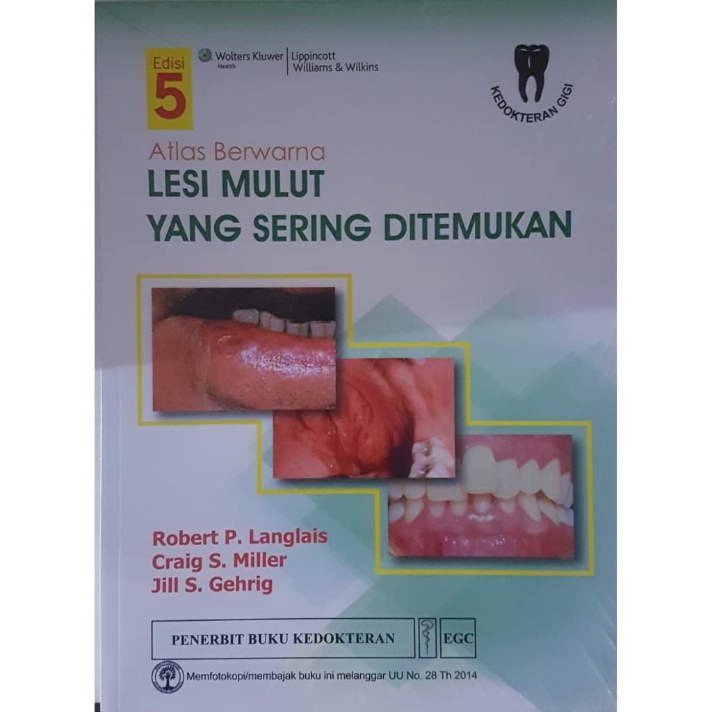 [ ORIGINAL ] Atlas Berwarna Lesi Mulut Yang Sering Ditemukan Edisi 5 - Langlais