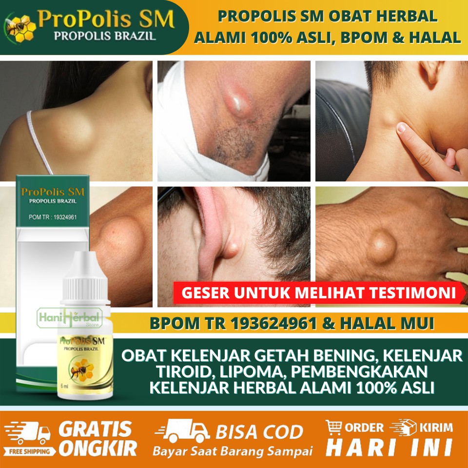 Cod Obat Untuk Benjolan Lipoma Kelenjar Getah Bening Tiroid Leher Bengkak Gondok Bisul Bungkul Dll Shopee Indonesia