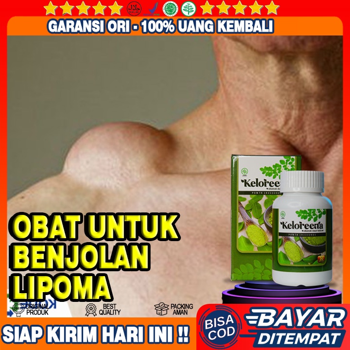 Jual Obat Benjolan Lipoma, Obat Penghilang Lipoma, Penghancur Lipoma ...