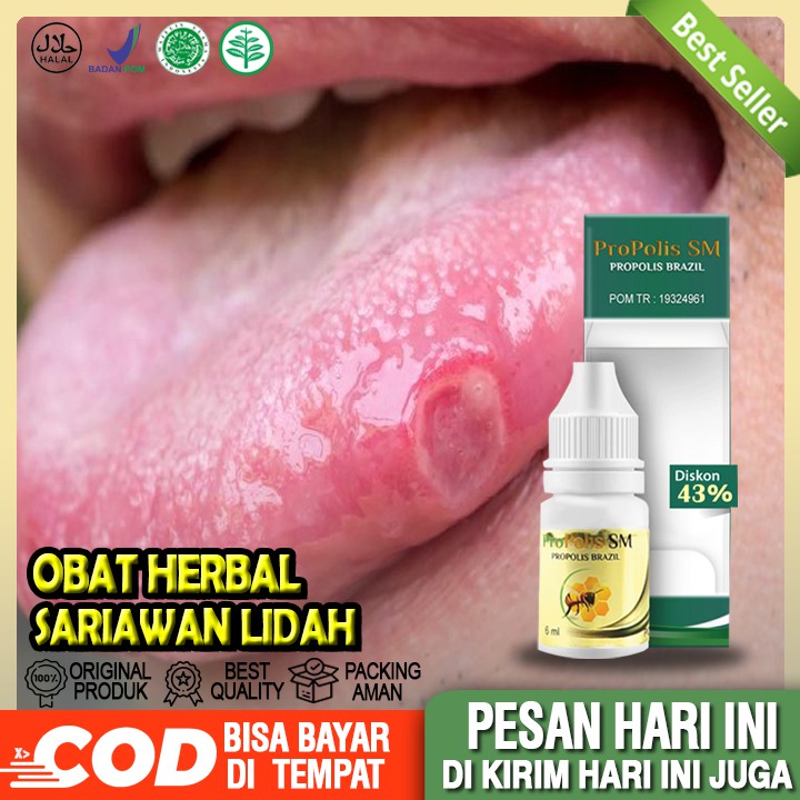 Obat Sariawan Di Lidah Obat Sariawan Di Lidah Ank Obat Sariawan Di Bawah Lidah Obat Buat Sariawan Shopee Indonesia