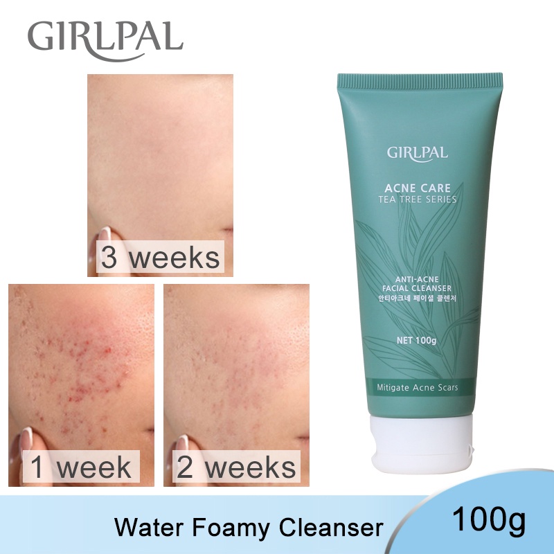 GIRLPAL Tea Tree Anti Acne Facial Cleanser Acne Treatment Facial Cleansing Foam Acne Wash 100g GPATF1003