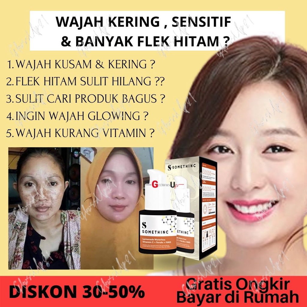 Serum Penghilang Flek Hitam SOMETHINC Lemonade Waterless Vitamin C+Ferulic+NAG Treatment Wajah