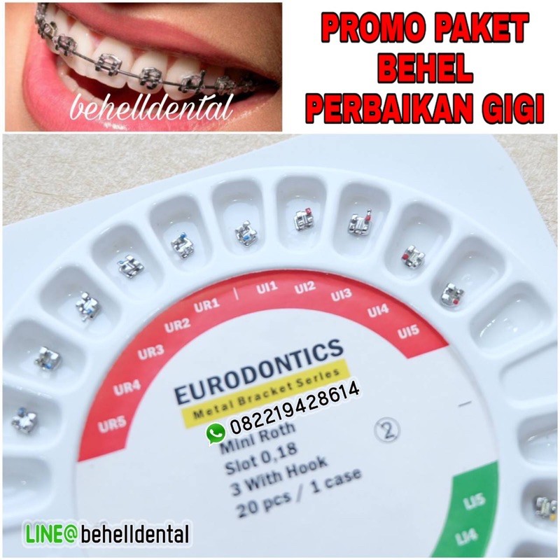 ORIGINAL PAKET BEHEL GIGI PERMANEN BRACKET EURODONTICS EURO METAL WITH HOOK 3 ROTH / BEHEL DENTAL KAWAT Untuk PERAWATAN PERBAIKAN Gigi - Ortho Orthodontic Eurodontic Behelldental