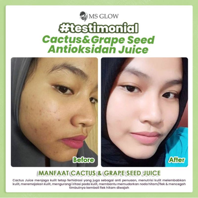 Ms Glow Moisturizer Cactus Original 100% Ms Glow Skincare Pelembab Viral The Best