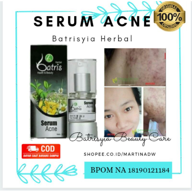 Serum anti acne 25ml obat jerawat batrisyia herbal