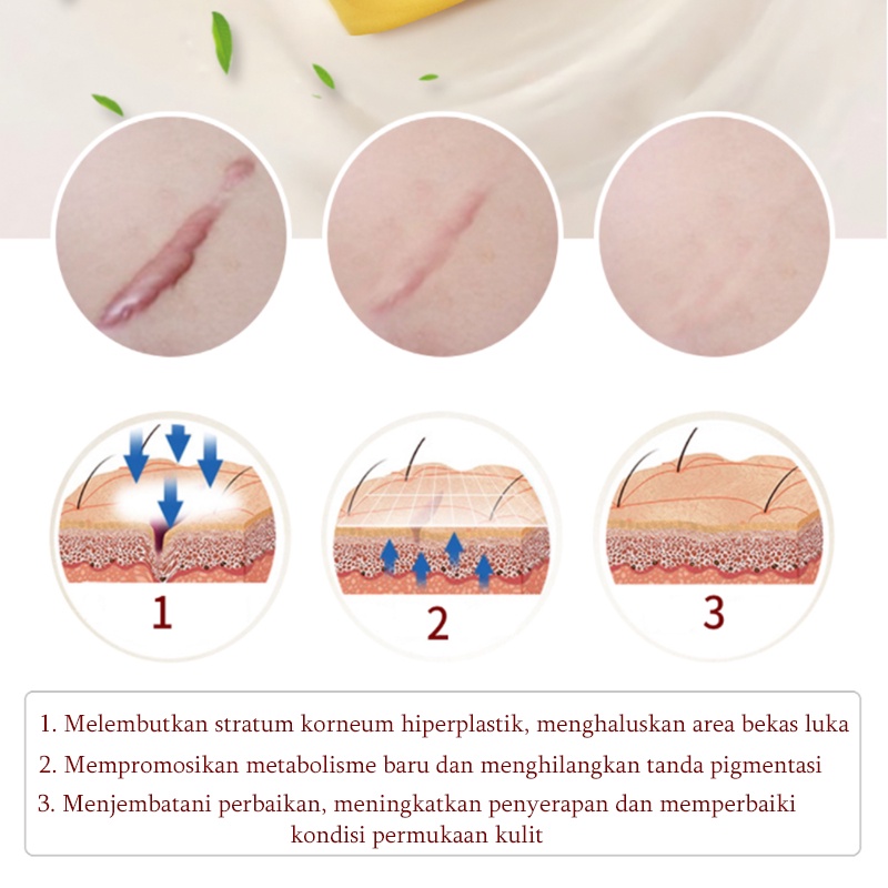 Krim Cream Salep penghilang luka bekas Menghilangkan stretch mark 20G Penghilang bekas luka yang ampuh Memperbaiki bekas luka bakar Bekas Jerawat Bekas luka lama Benjolan dan jerawat