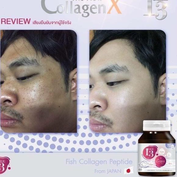 C5H7 Gee 13 The New Collagen X Original Thailand 100% ❤️A3