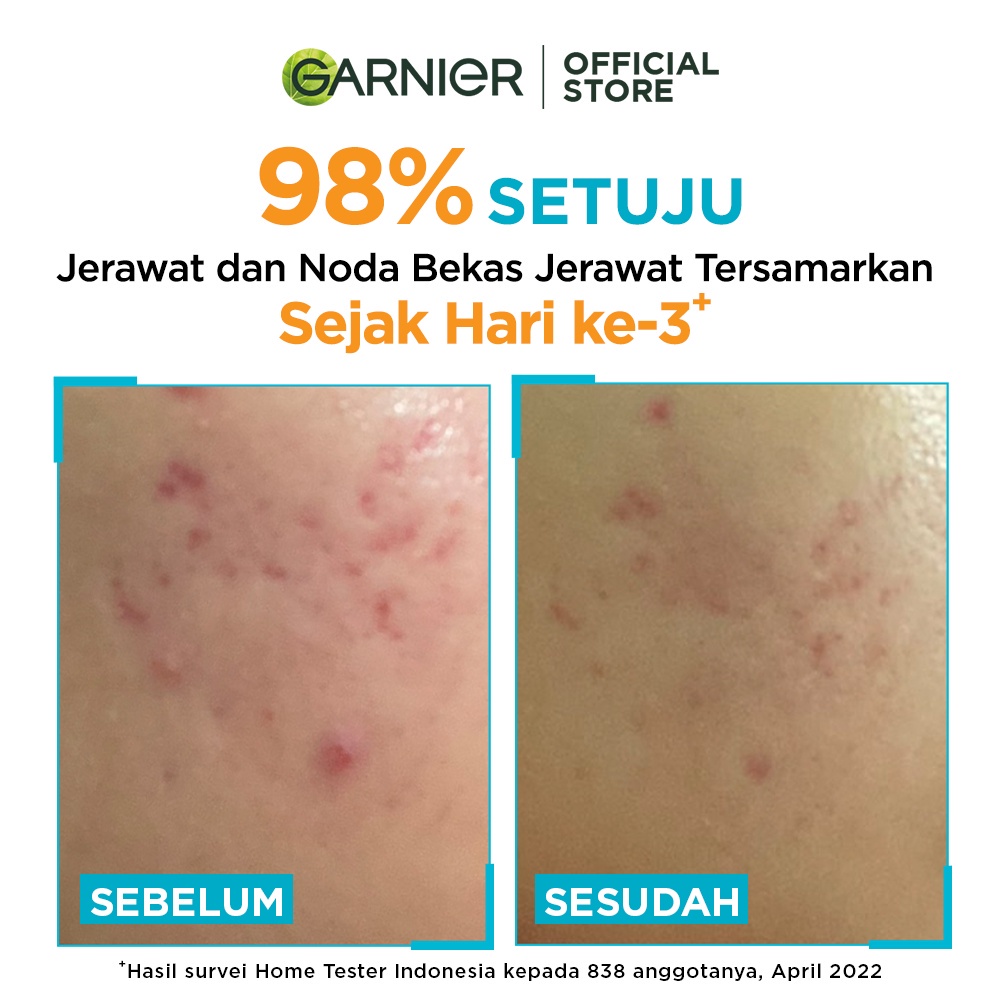 Garnier Bright Complete Anti Acne Booster serum - Skincare Lawan Jerawat