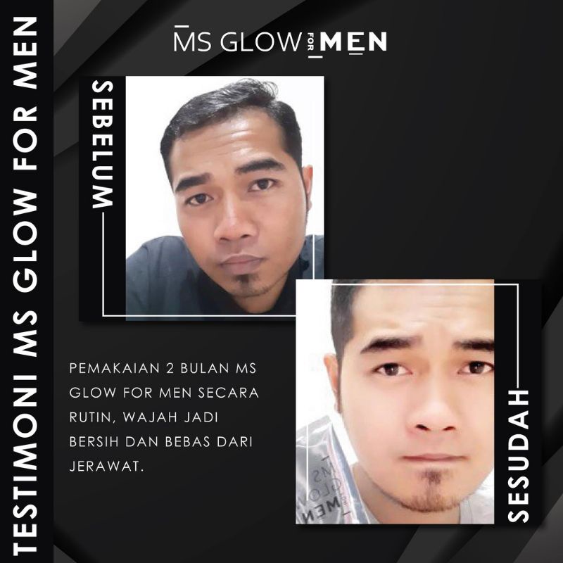 MSGLOW MEN PAKET LENGKAP MSGLOW FOR MEN SKINKER SEKINKER SCINCER SECINCER SCINKER SCINCARE SKINCARE WAJAH PRIA GLOWING PEMUTIH WAJAH PRIA JERAWAT ORIGINAL-2