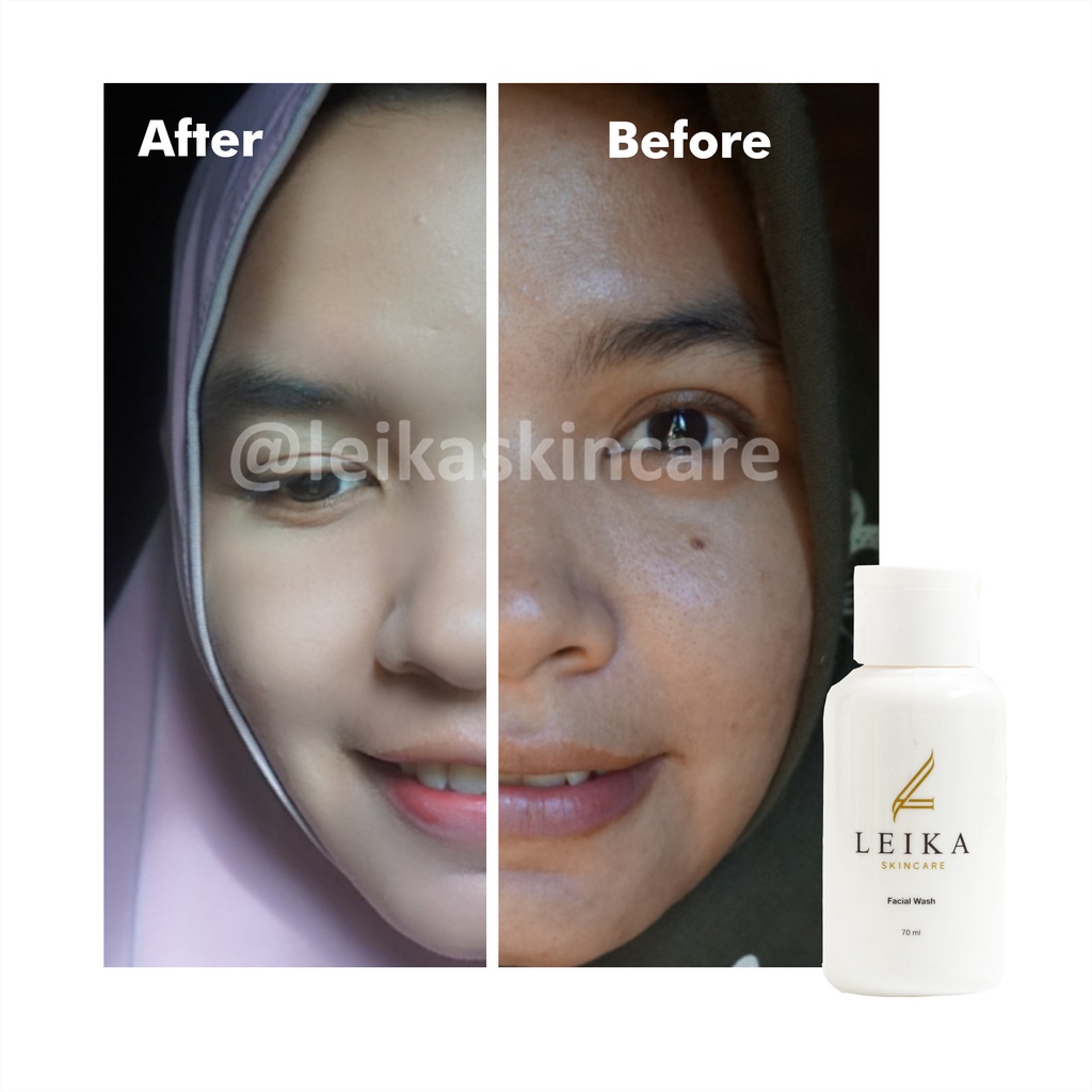 Sabun untuk Wajah Berminyak dan Berjerawat Ampuh Bisa untuk Membersihkan Kotoran di Wajah Asli 100% Halal BPOM Sabun Pembersih Wajah Facial Wash Leika Skincare 70ml Original