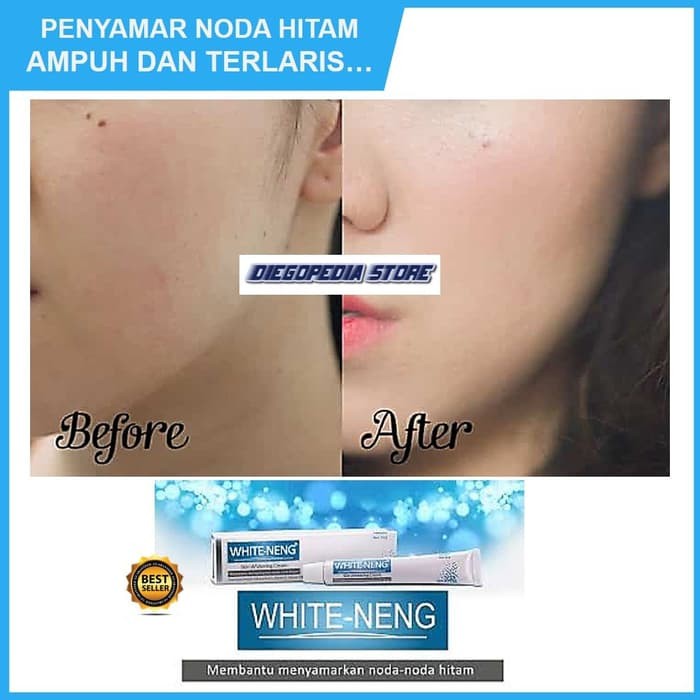 WHITE-NENG Skin Whitening Cream 10g