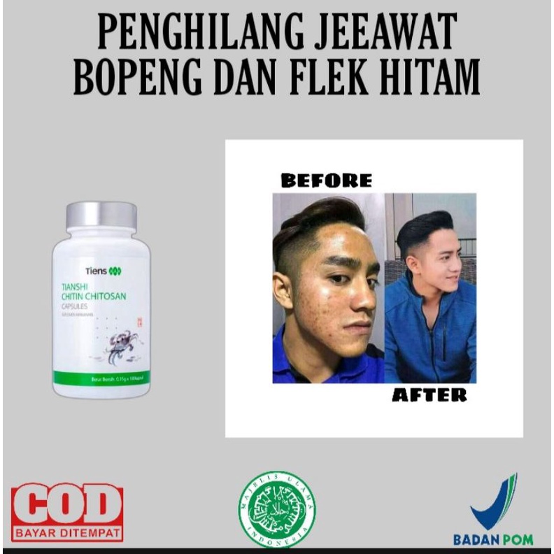 AMPUH Penghilang jerawat pria permanen ASLI Original Obat penghilang bekas jerawat bopeng bruntusan