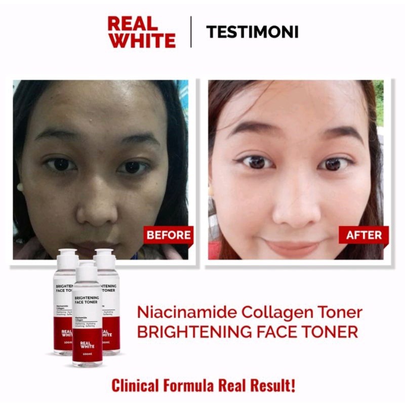 Real white brightening face toner/niacinamide collagen 100ml