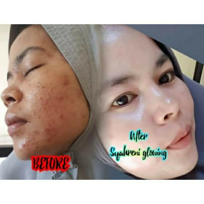 (COD) BPOM Paket Lengkap Skincare Syahreni Glowing Super Lengkap Komplit SYR original 100% Asli Ori Serum Gold Terbaru 2021 Versi Syahraeni Grosir Wajah Face mengatasi Jerawat Beruntusan Flek Hitam membandal perawatan terbaik Aman Skin Care Medan Resmi-4