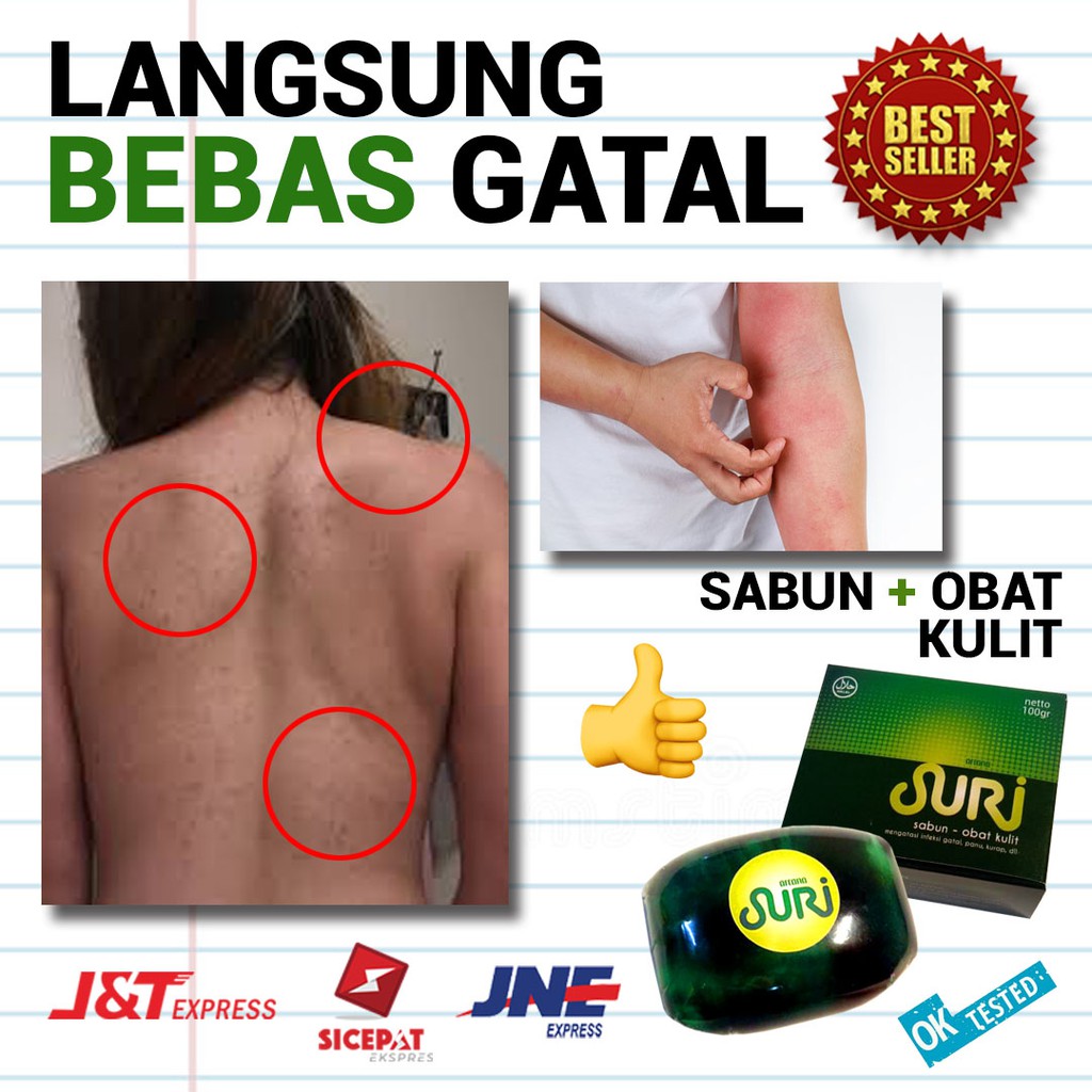 SURI – SABUN OBAT KULIT GATAL, PANU, EKSIM, KURAP, AMPUH