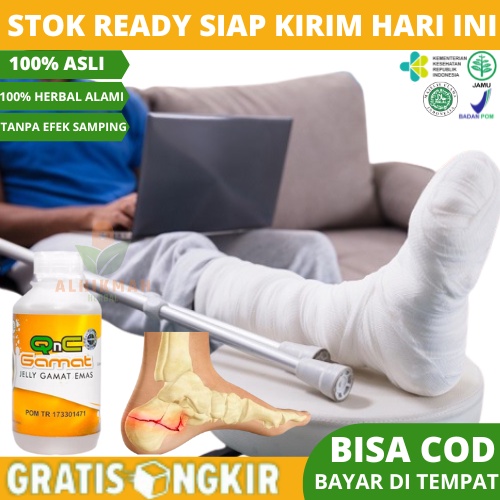 Obat Patah Tulang, Obat Tulang Retak, Obat Tulang Remuk, Obat Patah Tulang Tangan, Obat Patah Tulang