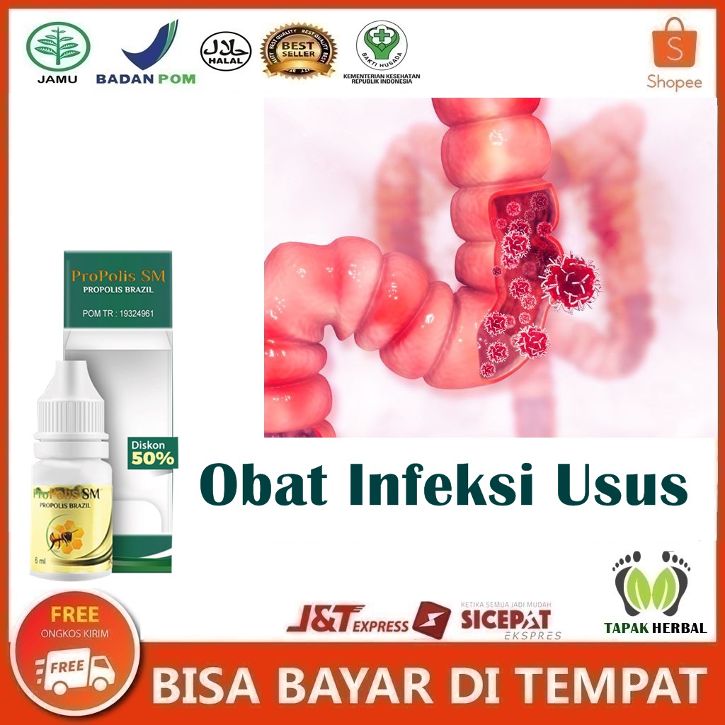 Obat Infeksi Usus, Obat Radang Usus, Luka Di Usus, Infeksi Usus Besar, Pengobatan Infeksi Usus, Cara