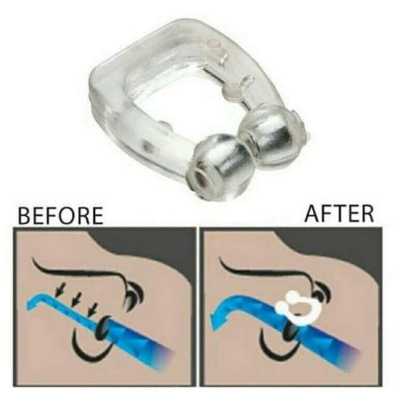 Alat anti Dengkur anti ngorok Snore free Magnetic Nose Clip