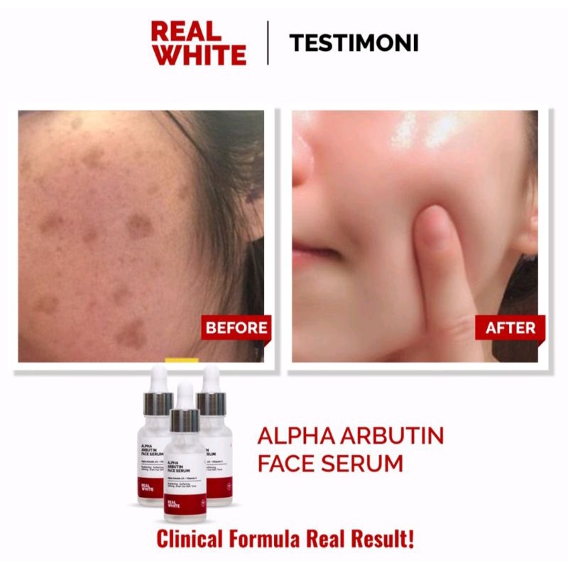 Real white alpha arbutin face serum 20ml