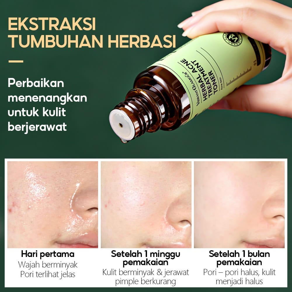 Vibrant Glamour Herbal Acne Treatment Toner mengatasi jerawat