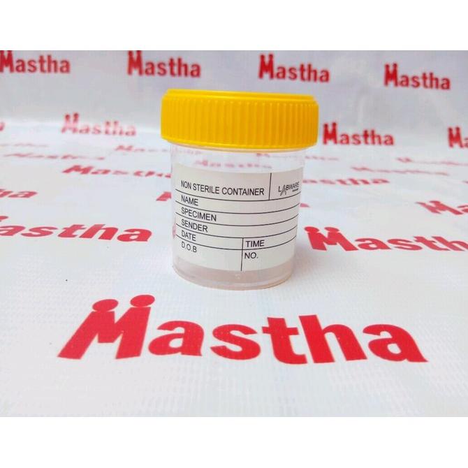 Urine Container 60 ml / Tempat Sampel Urine