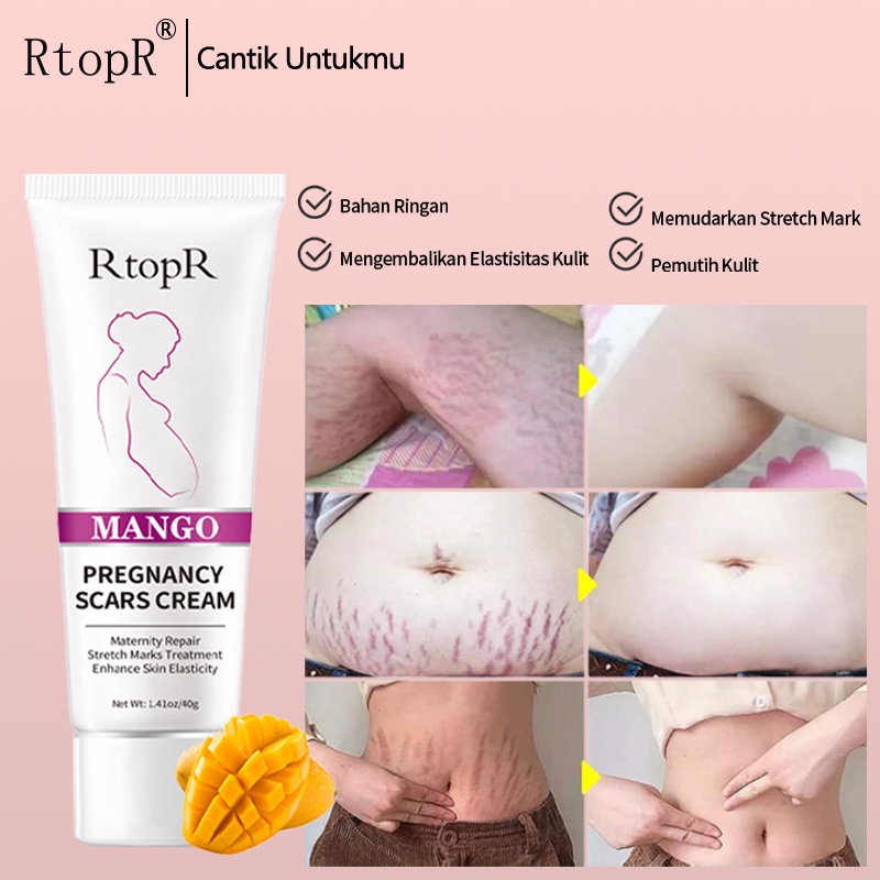 [Ori100%]RtopR Mango Pregnancy Scars Cream Maternity Repair Firming Enhance Skin Elasticity Stretch Marks Treatment Tubuh Postpartum Stretch Mark Perbaikan Krim Anti-Aging Kulit 40g