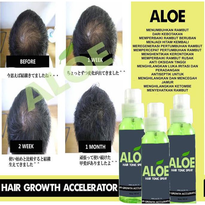 PENUMBUH RAMBUT ALOE BULU DADA KUMIS OBAT PEMBESAR GLUTAMEN ALAT VITAL