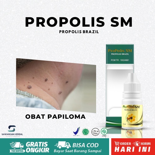 Obat Papiloma Leher, Penghilang Papiloma Leher, Obat Kutil Leher, Mengatasi Papiloma Pada Leher Deng