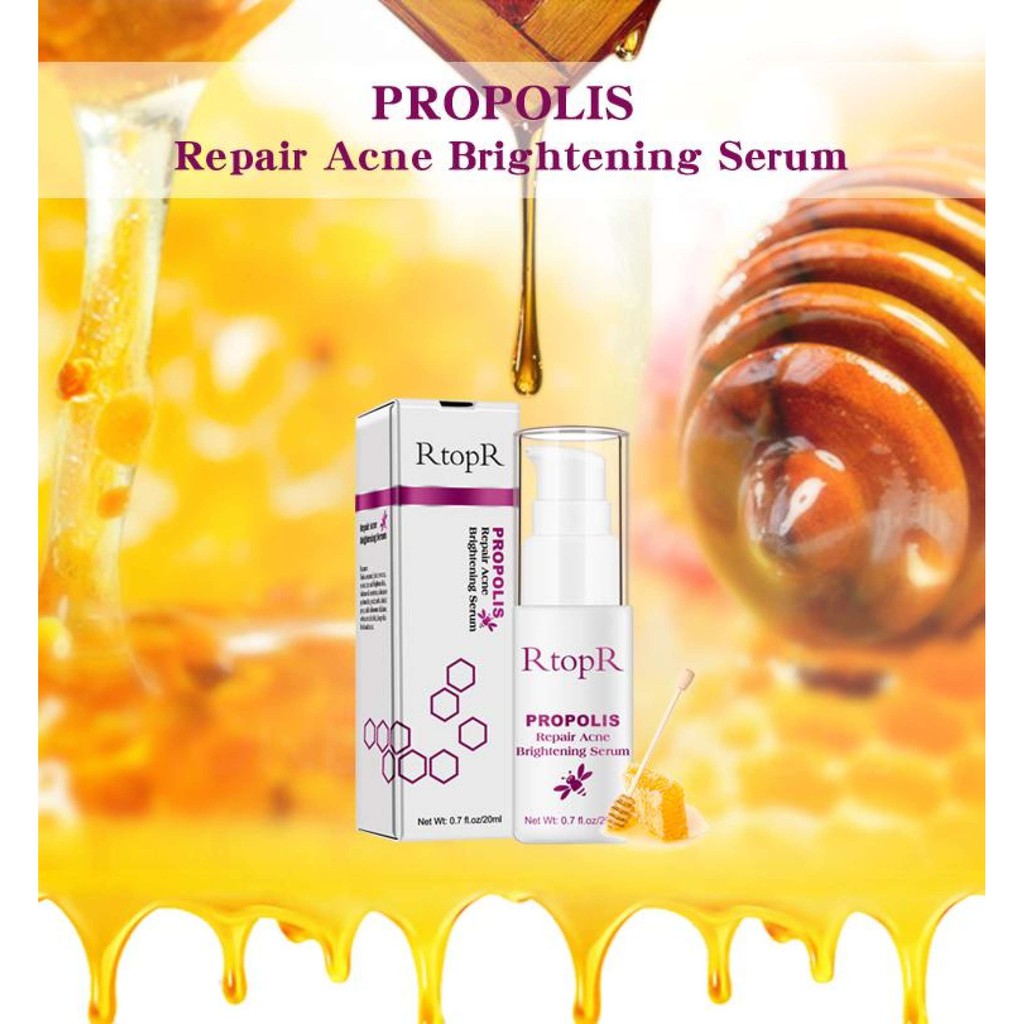 [100% Asli] RtopR Propolis Serum Pencerah Jerawat Perbaikan Pengecil Pori-pori Obat Jerawat dan Bekas Jerawat Wajah Bruntusan Bopeng Mengecilkan Pori - Por