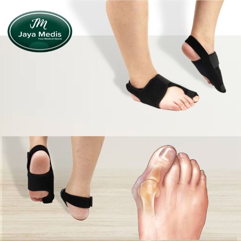 Korektor Bunion Belat Pelurus Kaki Brace Hallux Valgus - 2pcs