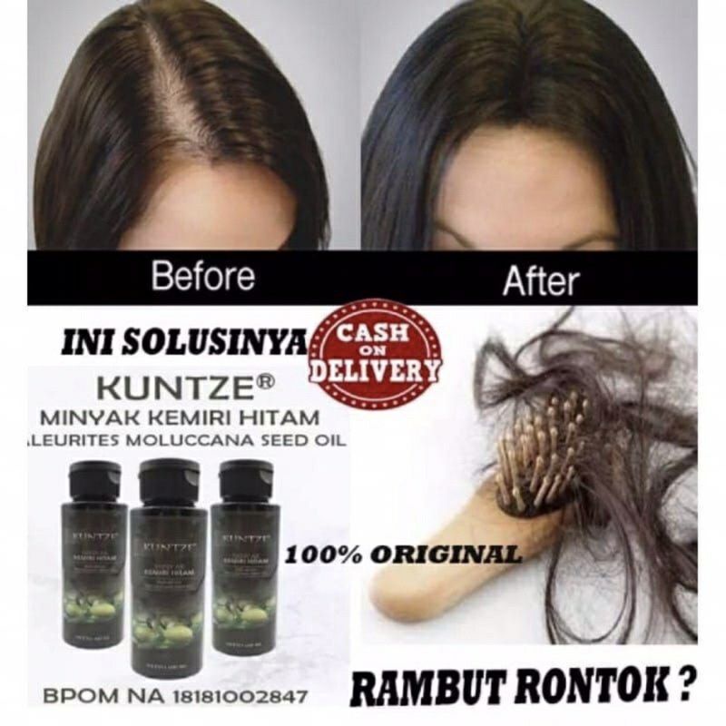 Kuntze MINYAK KEMIRI HITAM ASLI PENUMBUH RAMBUT / KEMIRI BLACK  / KUNTZE  Minyak Kemiri Hitam Origin