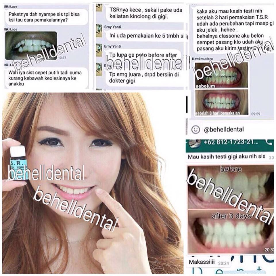 Pemutih gigi ampuh Tooth stain remover . whitening tooth / teeth