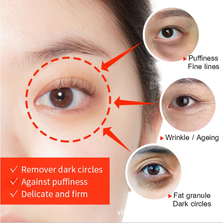 【ORIGINAL】Krim Mata Eye Cream Polypeptide Elastic Repair Eye Cream Krim mata lingkaran hitam 30g Remove Eye Pattern/ Eye Bags /Fat-Free Granules / Fade Dark circles / Moisturizing bpom