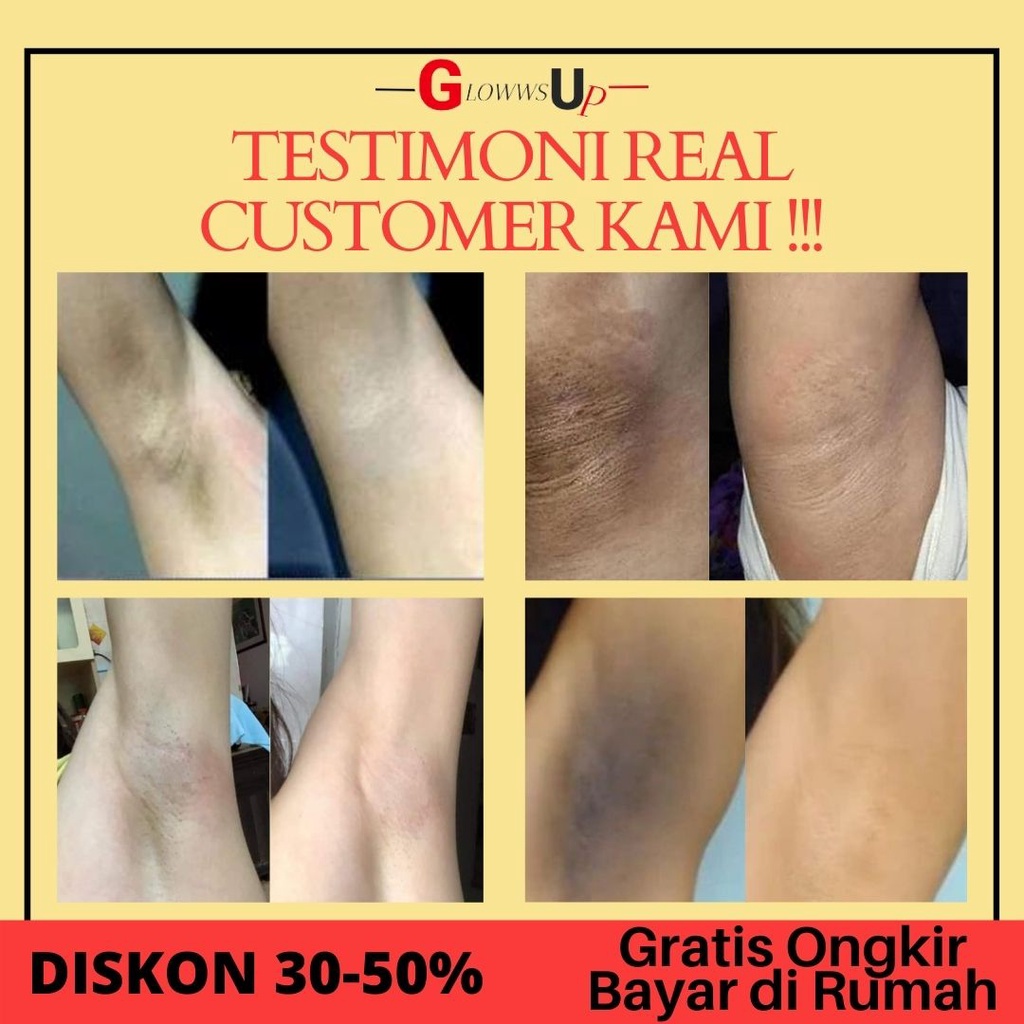 PEMUTIH KETIAK - ALPHA ARBUTIN - ALPHA ARBUTIN ORGANIC UNDERARM NIGHT CREAM 50GR - UNDERARM ALPHA