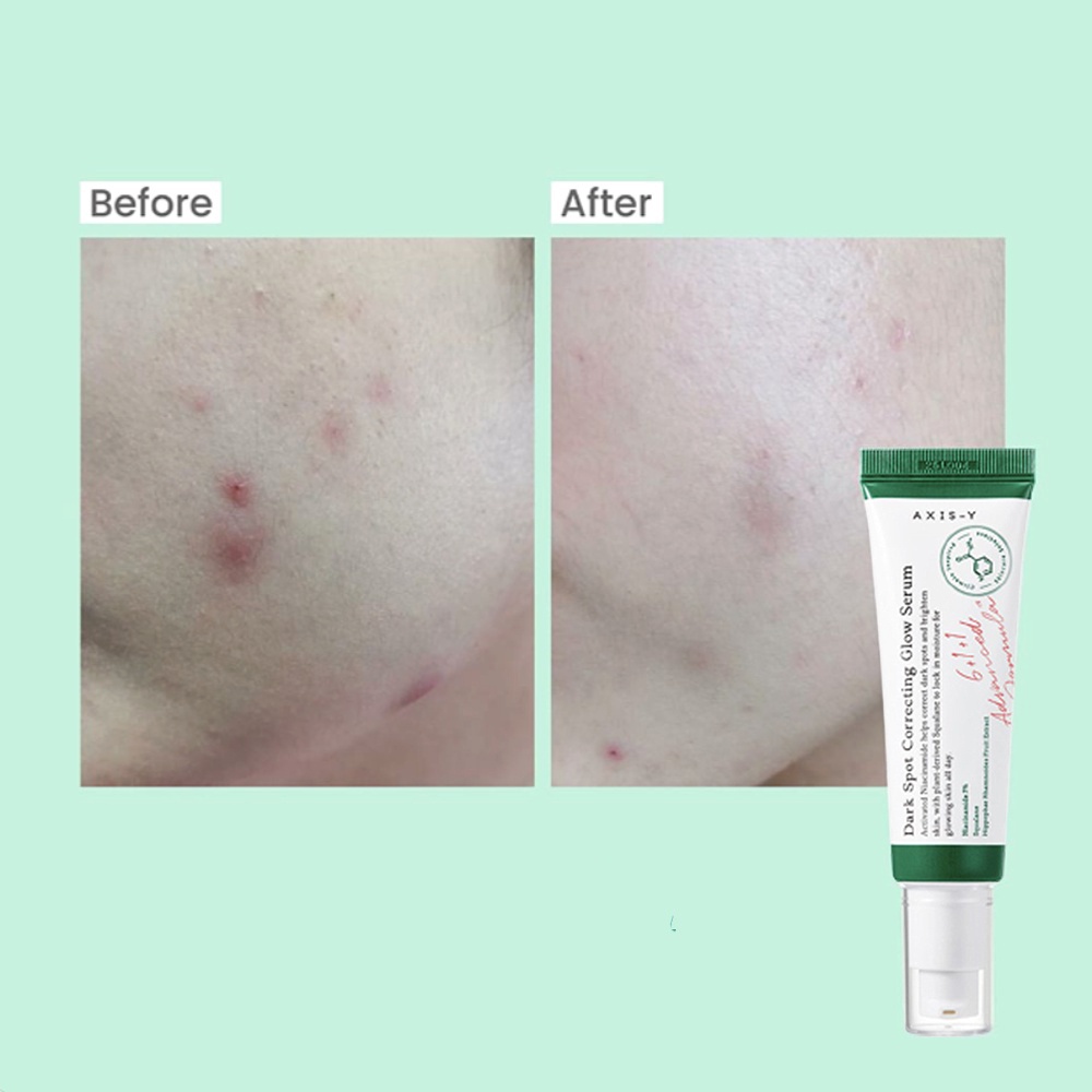 AXIS-Y Dark Spot Correcting Glow Serum 50ML/MUGWORT 100ML 100% ORI KOREA