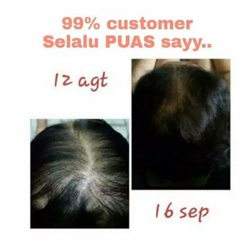 PAKET PENUMBUH RAMBUT BIO HERBAL GINSENG ORIGINAL , HARGA SEPAKET DAPAT SHAMPOO &amp; HAIR TONIC Rambut Merangsang Pertumbuhan Rambut Ampuh