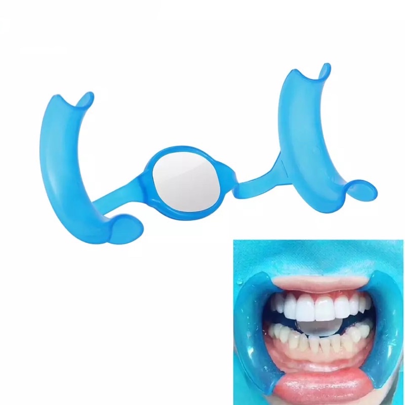 Pembuka mulut arc flex mirror cheek retraktor bleaching retractor mouth opener gag gate whitening