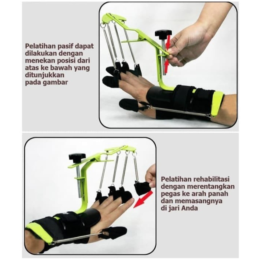 Alat terapi Stroke Dynamic Orthosis Stroke Fingers Hand Physiotherapy Fisioterapi