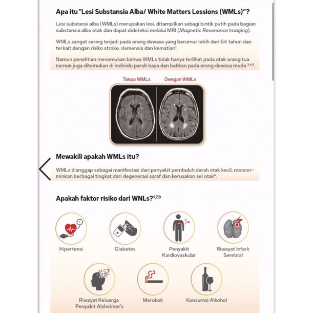 Tocovid suprabio 200 mg ( perlindungan otak terhadap resiko stroke )