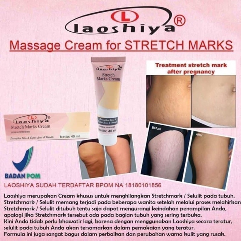 Laoshiya stretch marcks cream