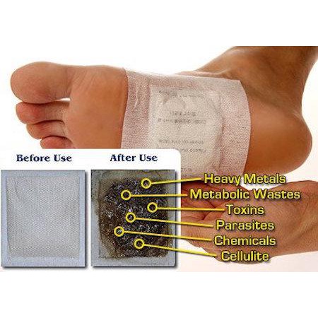 Koyo Penyerap Racun Tubuh - Detox Foot Patch Gold Original Bamboo