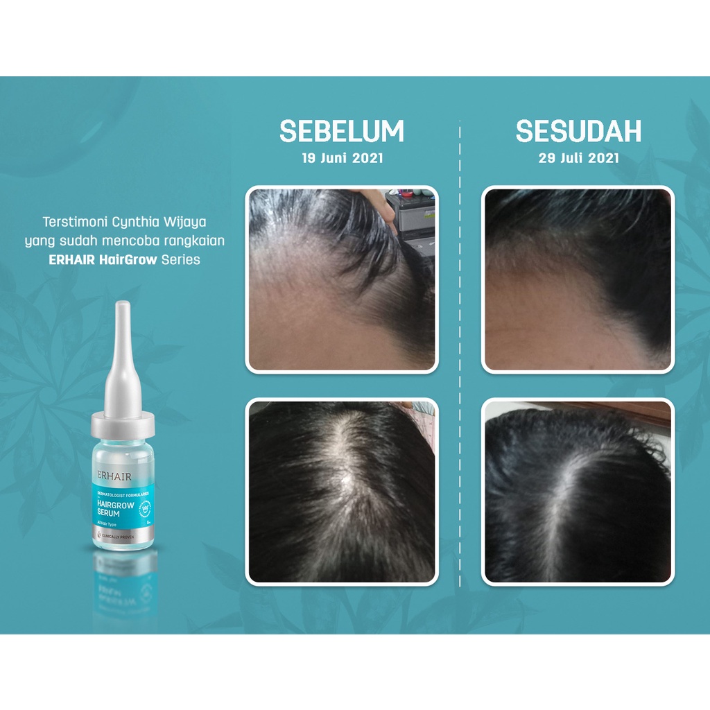 ERHAIR Paket Penumbuh Rambut Rontok Lengkap ERHA Hairgrow Shampoo 100 ml + Serum + Tonik