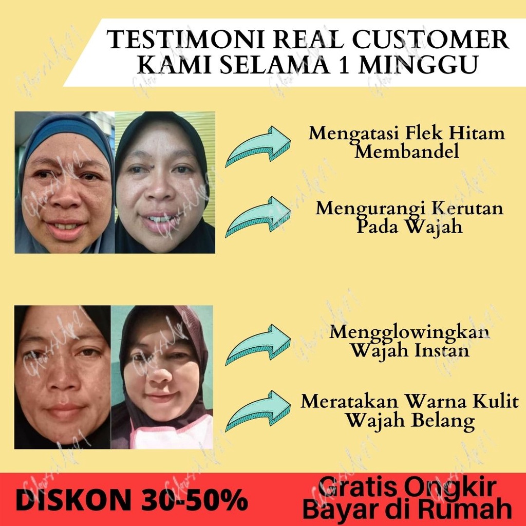 Serum Penghilang Flek Hitam SOMETHINC Lemonade Waterless Vitamin C+Ferulic+NAG Treatment Wajah