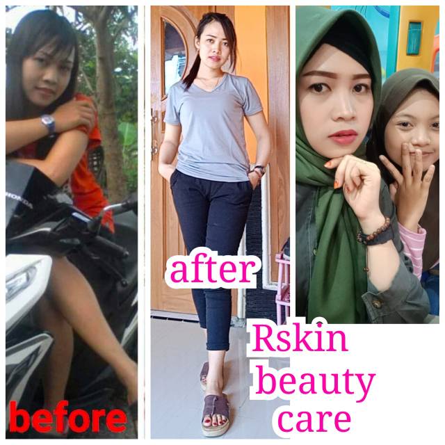 Paket wajah Rskin Beauty Care
