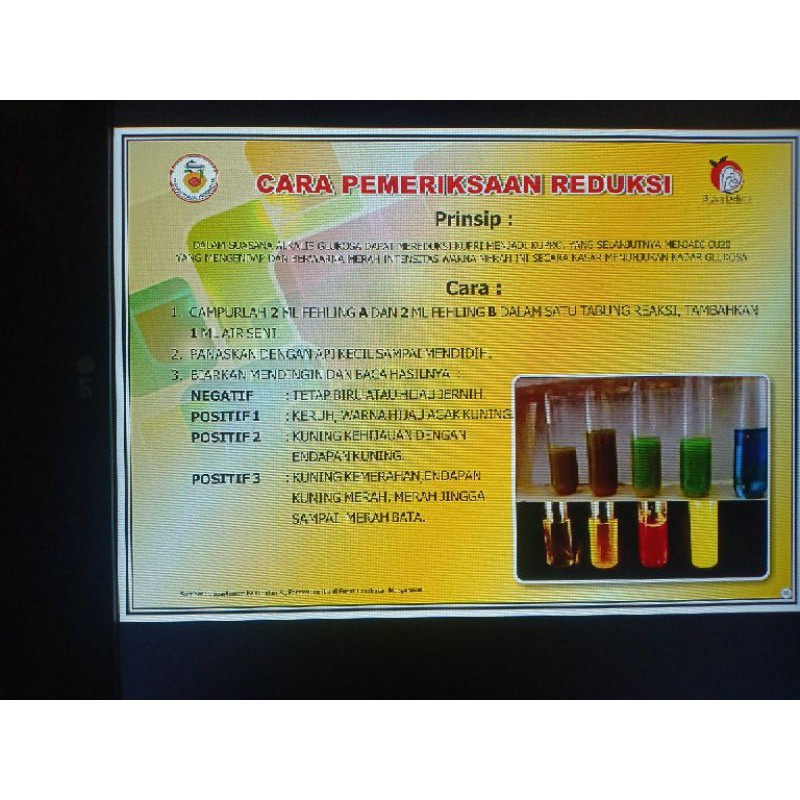 

POSTER CARA PEMERIKSAAN REDUKSI (90)
