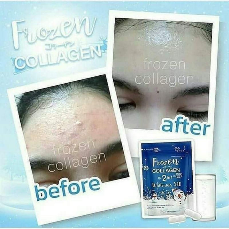 ready collagen frozen