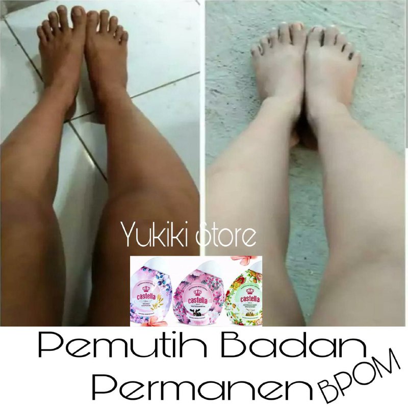 PEMUTIH BADAN PERMANEN - CASTELLA LOTION - PEMUTIH BADAN BPOM - PEMUTIH BADAN PERMANEN CEPAT - PEMUTIH BADAN DALAM 3 HARI - PEMUTIH BADAN ORI - LOSION LOTION PEMUTIH BADAN BERKHASIAT AMPUH MANJUR - TERMURAH TERLARIS AMAN - ORIGINAL - COD