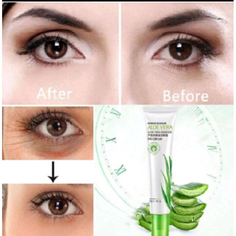 0PENGHILANG KANTONG MATA EYE BAG REMOVAL